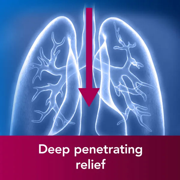 Benylin Chesty Coughs Original - 300ml