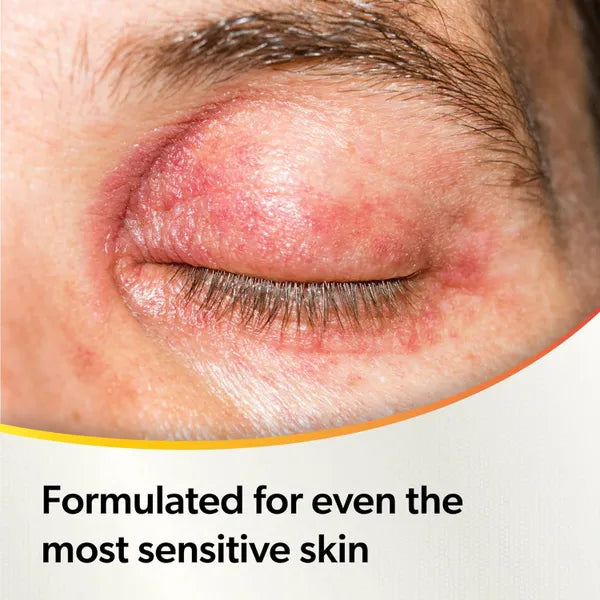 Optase Protect Eyelid Cleansing Spray – 100ml